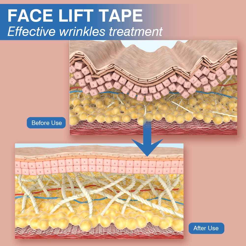 Anti-Wrinkle Tape Facial Myofascial Lift Tape 2.5CM x 5M,2 Rolls - TTpen